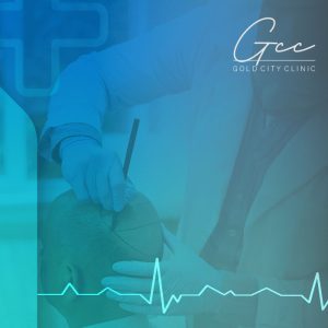 Billy Bob Thornton's Hair Transplant Truth Revealed - Acıbadem Best